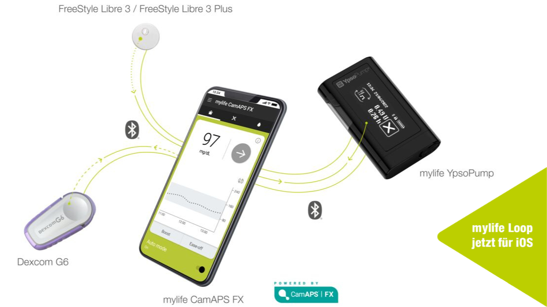 Life Loop Machine Abschnitt: Informationsmaterial | mylife Loop: Das AID-System von ...